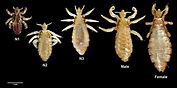 Body Lice | symptoms, diagnosis, treatment, pictures, home remedies