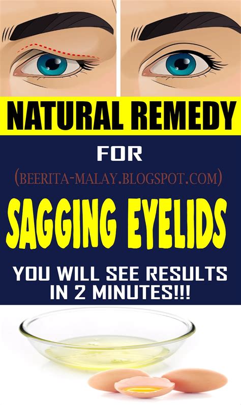 Natural Remedy For Sagging Eyelids You Will See Results In 2 Minutes