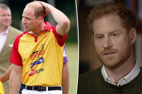 Prince Harry Defends William Baldness Comments In New Interview