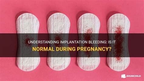 Understanding Implantation Bleeding Is It Normal During Pregnancy
