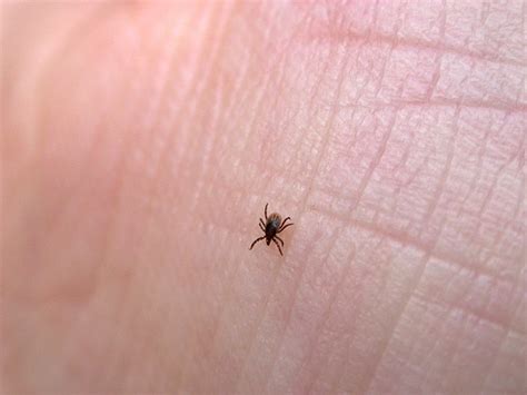 Know The Signs Of Lyme Disease Edward Elmhurst Health