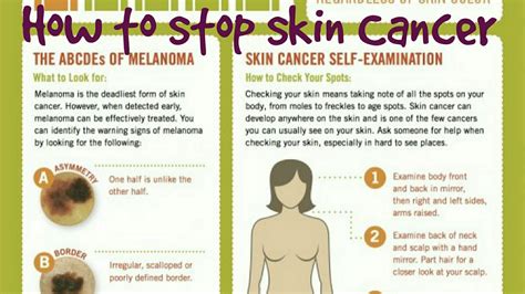 How To Check A Mole On Your Skin For Cancer Youtube