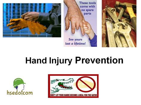 Ppt Hand Injuries Prevention Safety Training Ppt