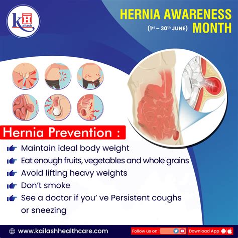 Hernia Awareness Month 1st 30th June 2021