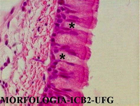 Biologia Celular E Tecidual Epitélio Glandular