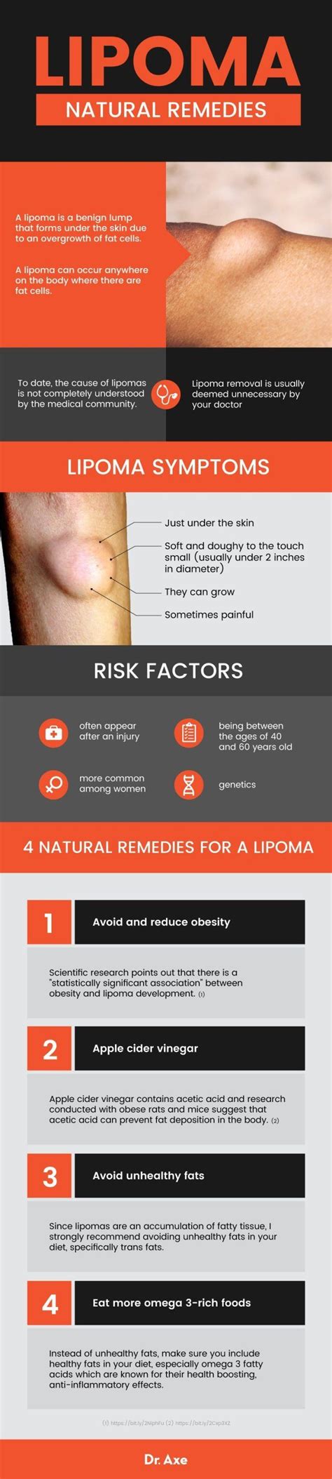 What Is A Lipoma Symptoms Causes 4 Natural Remedies Natural