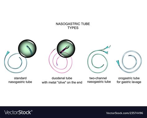 Types Nasogastric Tubes Royalty Free Vector Image