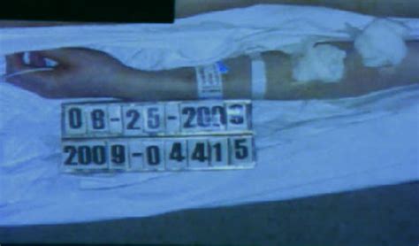 Michael Jackson Shocking Autopsy Photo Released