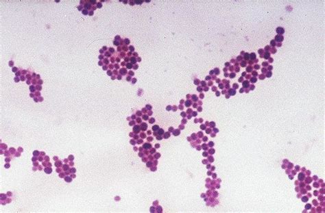 Streptococcus Pneumoniae Gram Stain Streptococcus Pneumoniae In