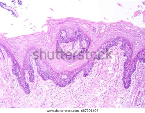Histology Human Submaxillary Gland Tissue Show Stock Photo Shutterstock