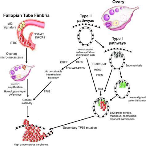 Pathogenesis Pathways Of Ovarian Cancer Schematic Representation Of