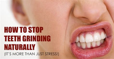 How To Stop Teeth Grinding Naturally Its More Than Just Stress