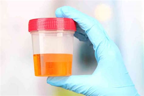 Obtain The Certainties On Completing Urine Prescription Medication