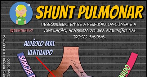 O Que é Shunt Pulmonar