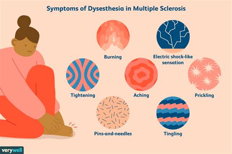Dysästhesie bei MS Symptome Ursachen Diagnose und Behandlung