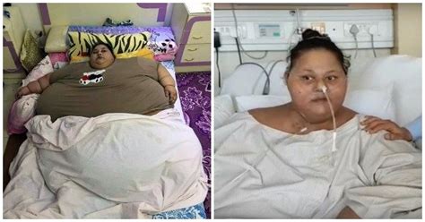 Worlds Heaviest Woman Loses Half Her Weight In 2 Months After Coming To India For Treatment