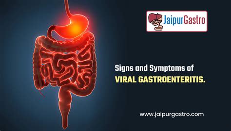 Signs And Symptoms Of Viral Gastroenteritis Jaipur Gastro Clinic