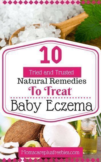 10 Simple Baby Eczema Natural Remedies Natural Eczema Remedies Baby