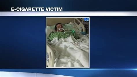 Man Hospitalized After E Cigarette Explodes In His Face Wkrc
