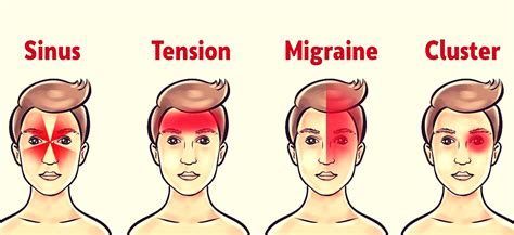 4 Most Usual Types Of Headaches What They Indicate About Your Health