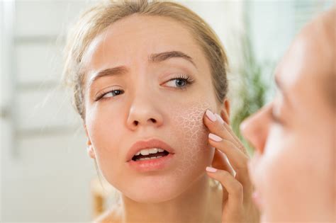 5 Reasons Why Your Skin Is Always Dry Essence Vale