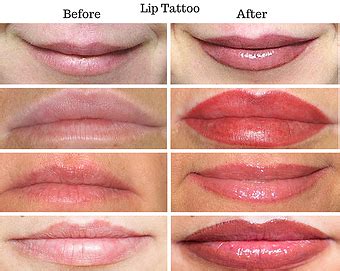 If you enjoy romancing life, or want to celebrate a great relationship, you can get a lips tattoo anywhere on your body. Home - Tattoo Cosmetics | Microdermabrasion benefits ...