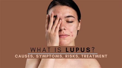 Lupus What Causes This Autoimmune Condition Types Symptoms