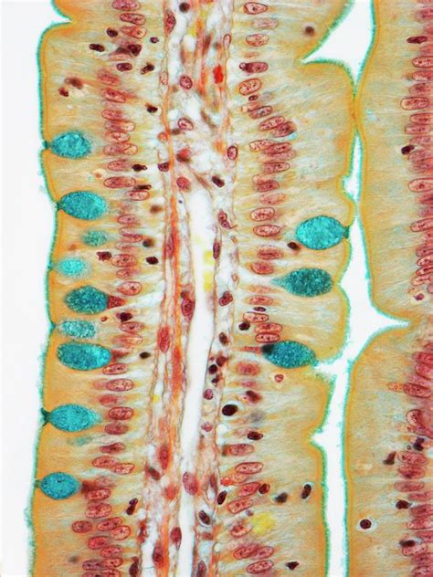 Small Intestine Photograph By Steve Gschmeissner Science Photo Library