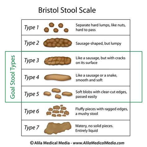 Bristol Stool Chart Type 1 Treatment Bristol Stool Chart Types Of