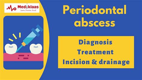 Periodontal Abscess Part 2 Diagnosis And Treatment L Incision And