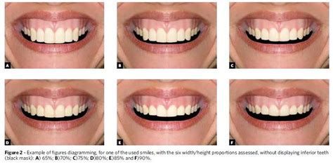Different Tooth Shapes Dental News Network