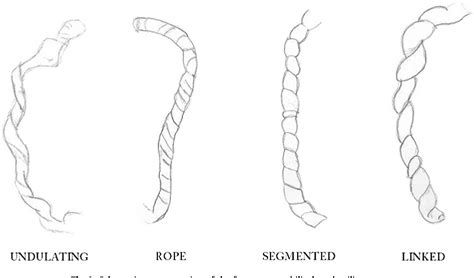 Pdf Gross Patterns Of Umbilical Cord Coiling Correlations With