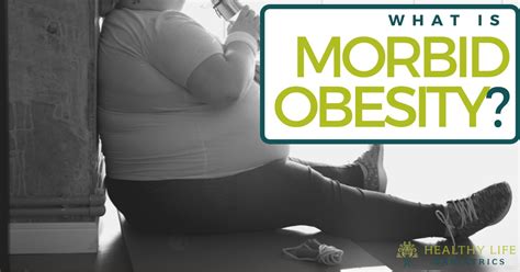 Morbid Obesity What Is It And How Can It Affect You
