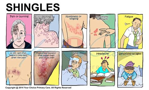 Shingles Your Choice Primary Care You Choi Md Internal Medicine