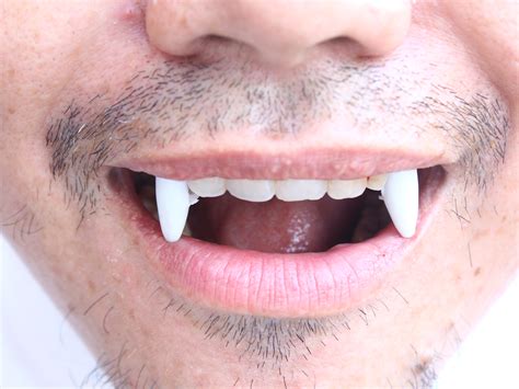 How To Get Vampire Teeth At The Dentist Vampire Fangs Teeth Dental
