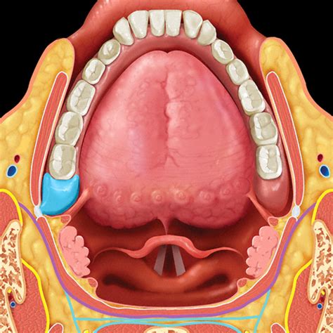 Oral Cavity And Oropharyngeal Squamous Cell Cancer Key Imaging