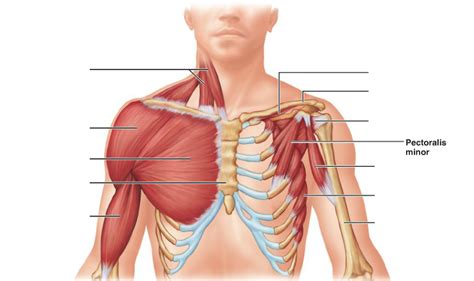 After a discussion with the patient about her treatment options, she elected for surgical repair of the pectoralis major tendon. Pectoralis minor - Pectoral Muscles