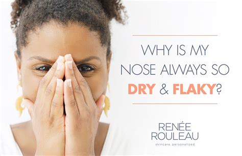 If Your Nose Suffers From Dryness Flaking Or Peeling Skin This