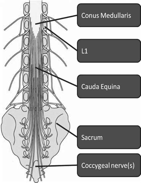 Figure Of The Lower Spinal Cord Highlighting Conus Medullaris And Cauda