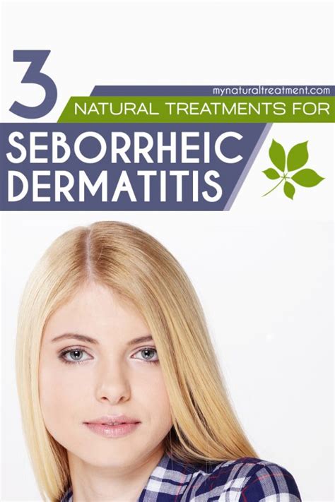 Natural Treatments For Seborrheic Dermatitis That Work