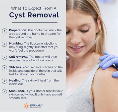 Dermatologist In Palm Beach That Removes Cysts With Blue Cross Blue