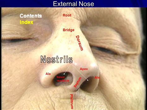Nose Blind Meaning