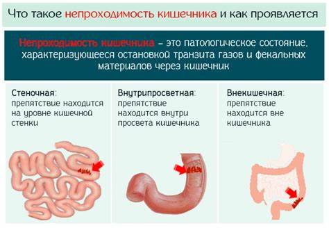 Непроходимость кишечник операция диета