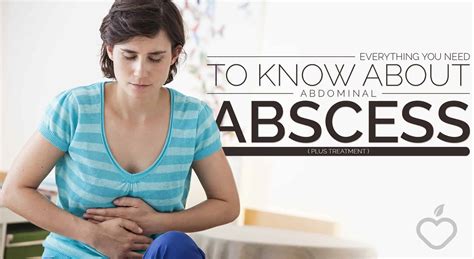 everything you need to know about abdominal abscess plus treatment 2023