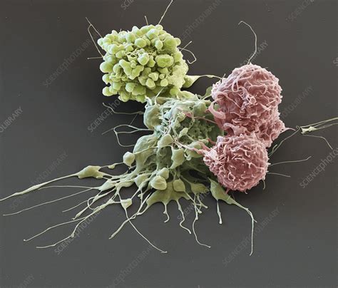 White Blood Cells Attacking Cancer Cells Sem Stock Image C0459777