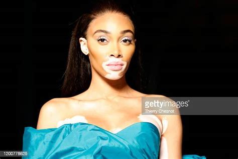 Supermodel Winnie Harlow Photos And Premium High Res Pictures Getty