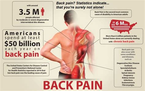 Sex And Back Pain Diagnosis Causes Treatments