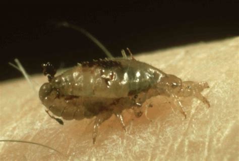 Where Do Lice Come From Bugs That Look Like Lice