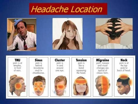 Headache Types Headache Location Headache Chart Headache