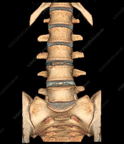 Healthy Lower Spine 3d Ct Scan Stock Image C0487469 Science